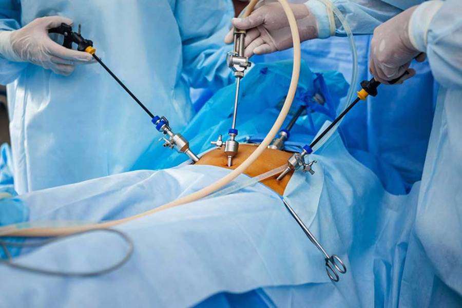 advanced laparoscopic surgery in Undri Pune
