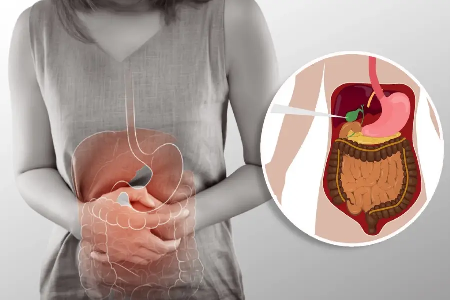 Woman holding stomach in pain with gallbladder illustration – Gallstone Treatment in Pune