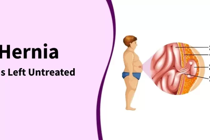 Illustration showing complications when hernia left untreated