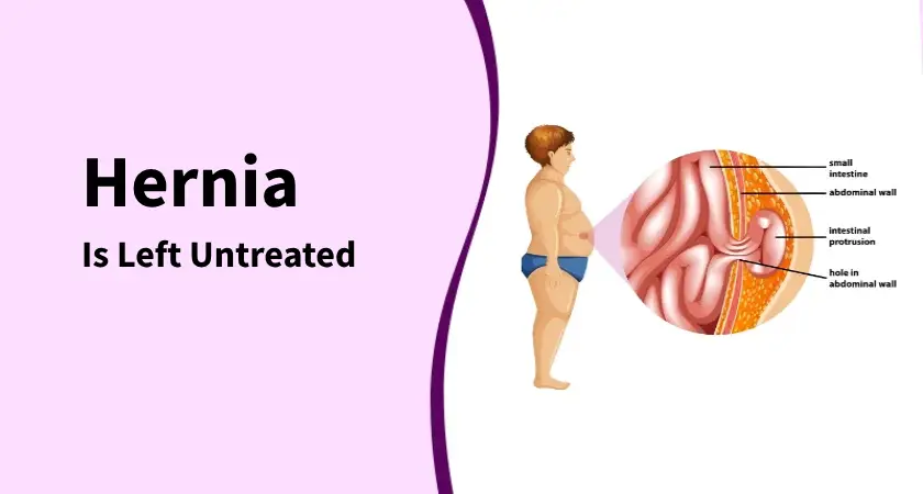 Illustration showing complications when hernia left untreated