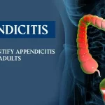 How to Identify Appendicitis in Kids and Adults – Visual of inflamed appendix in human body