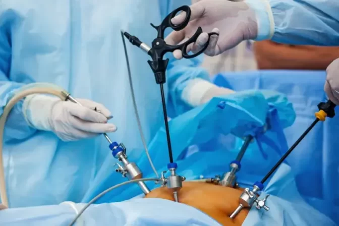 Surgeons performing laparoscopic surgery using advanced instruments, showing the possible risks and complications of laparoscopic surgery.