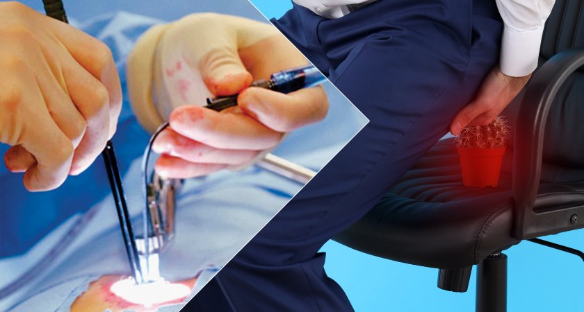 Advanced Laser Treatment for piles, fistula, and fissure in Pune – painless and effective surgery.